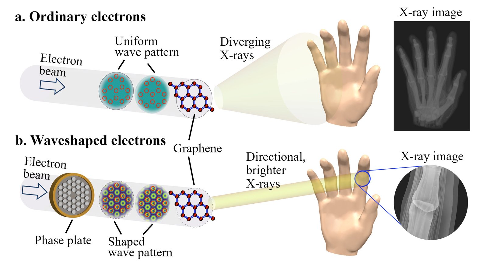 X-rays